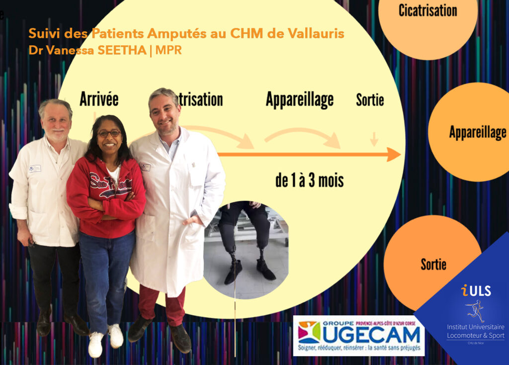 Dr Seetha MPR spécialisée dans le suivi des patients amputés au CHM de Vallauris