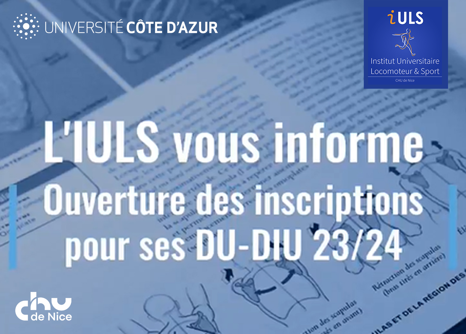 Notez les dates d'ouverture des inscriptions aux DU-DIU IULS 2023-2024!
