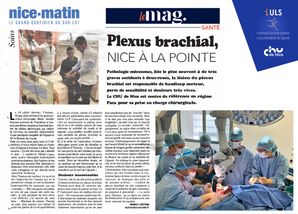 Article dans Nice Matin sur le Plexus Brachial, spécialité du Pr Camuzard!